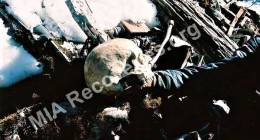 Human remains
